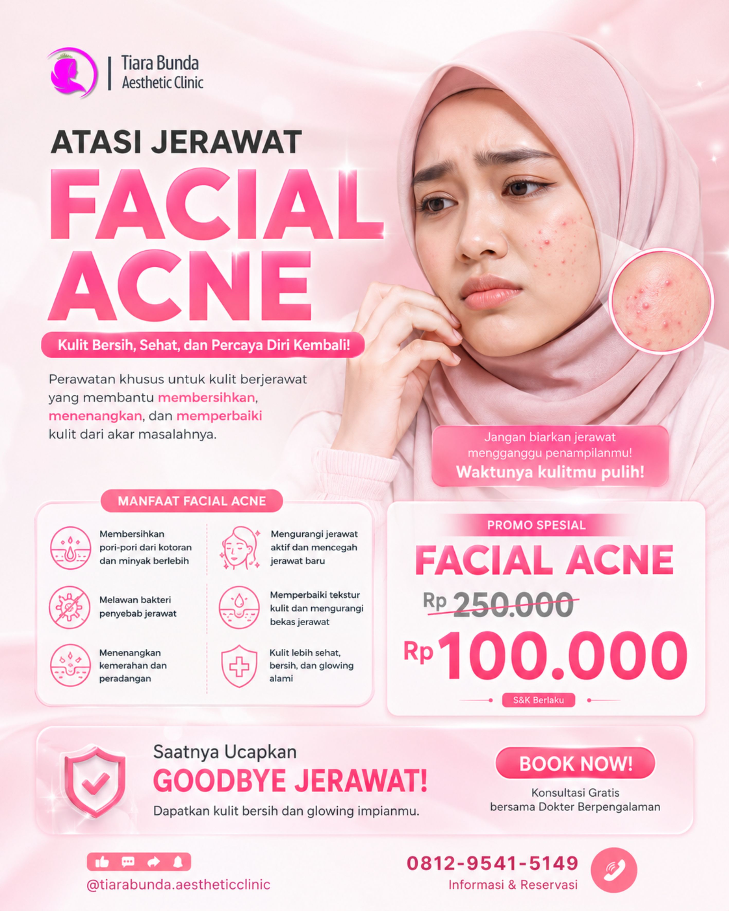 Facial Acne Treatment