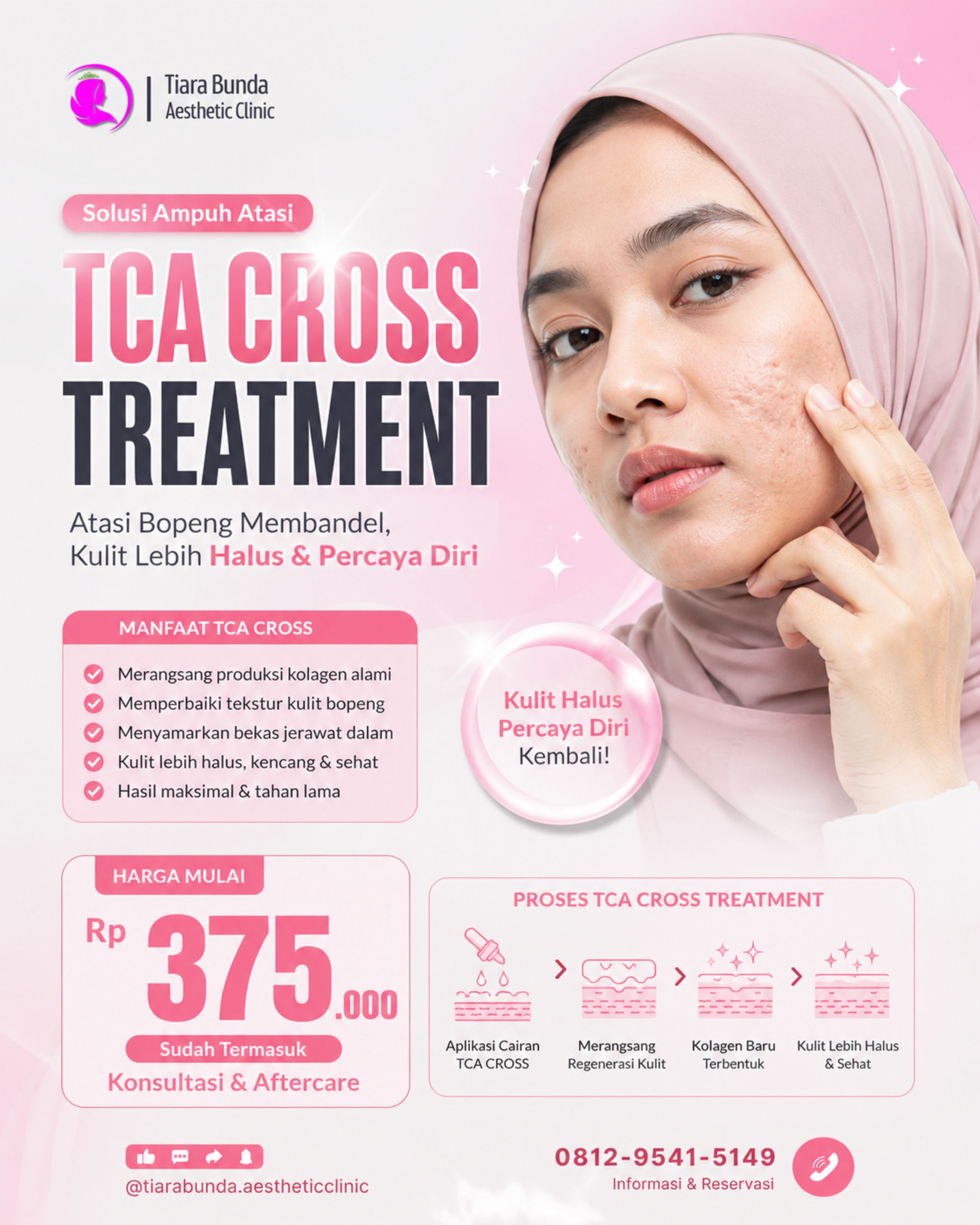 TCA CROSS Treatment