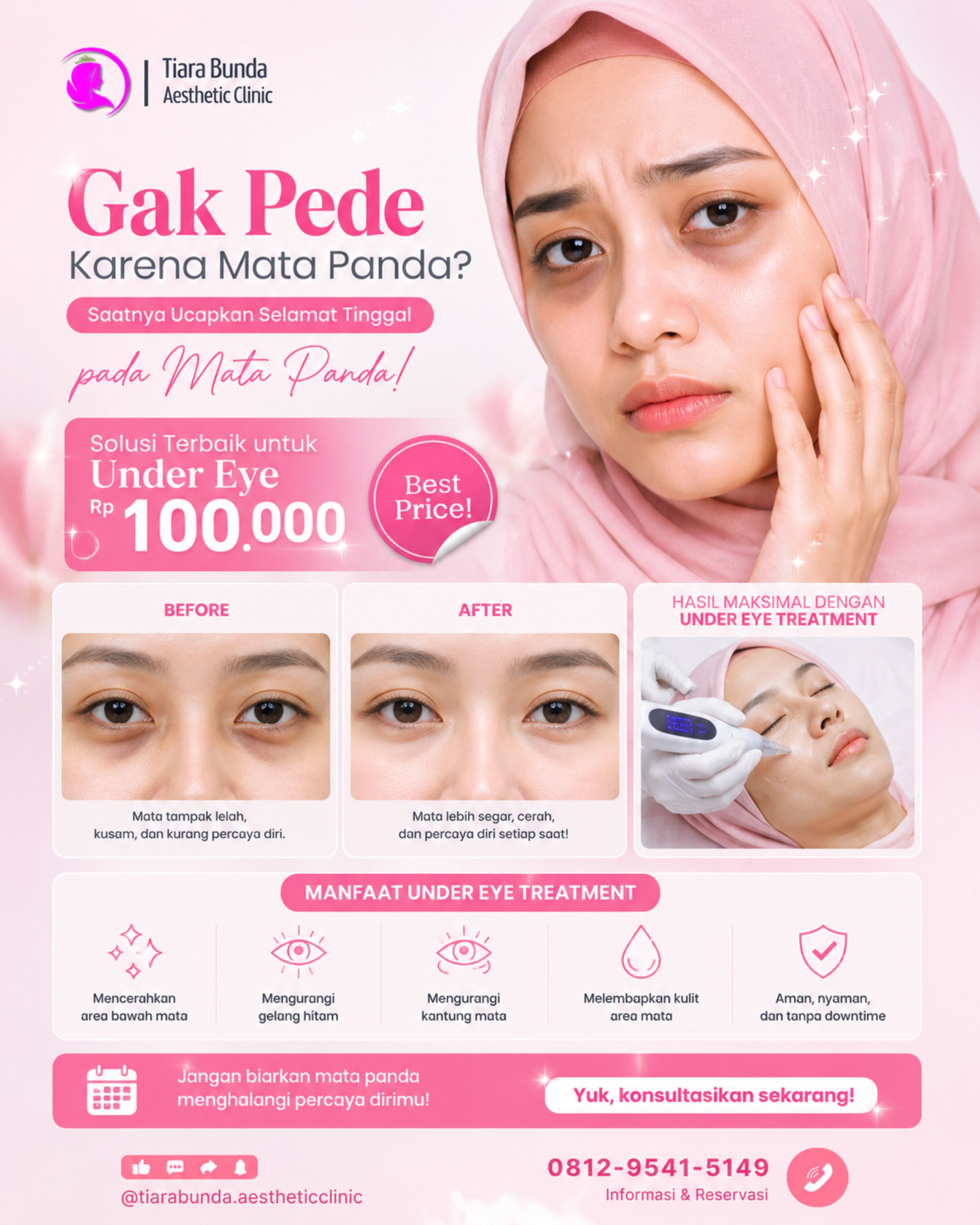 Under Eye Treatment