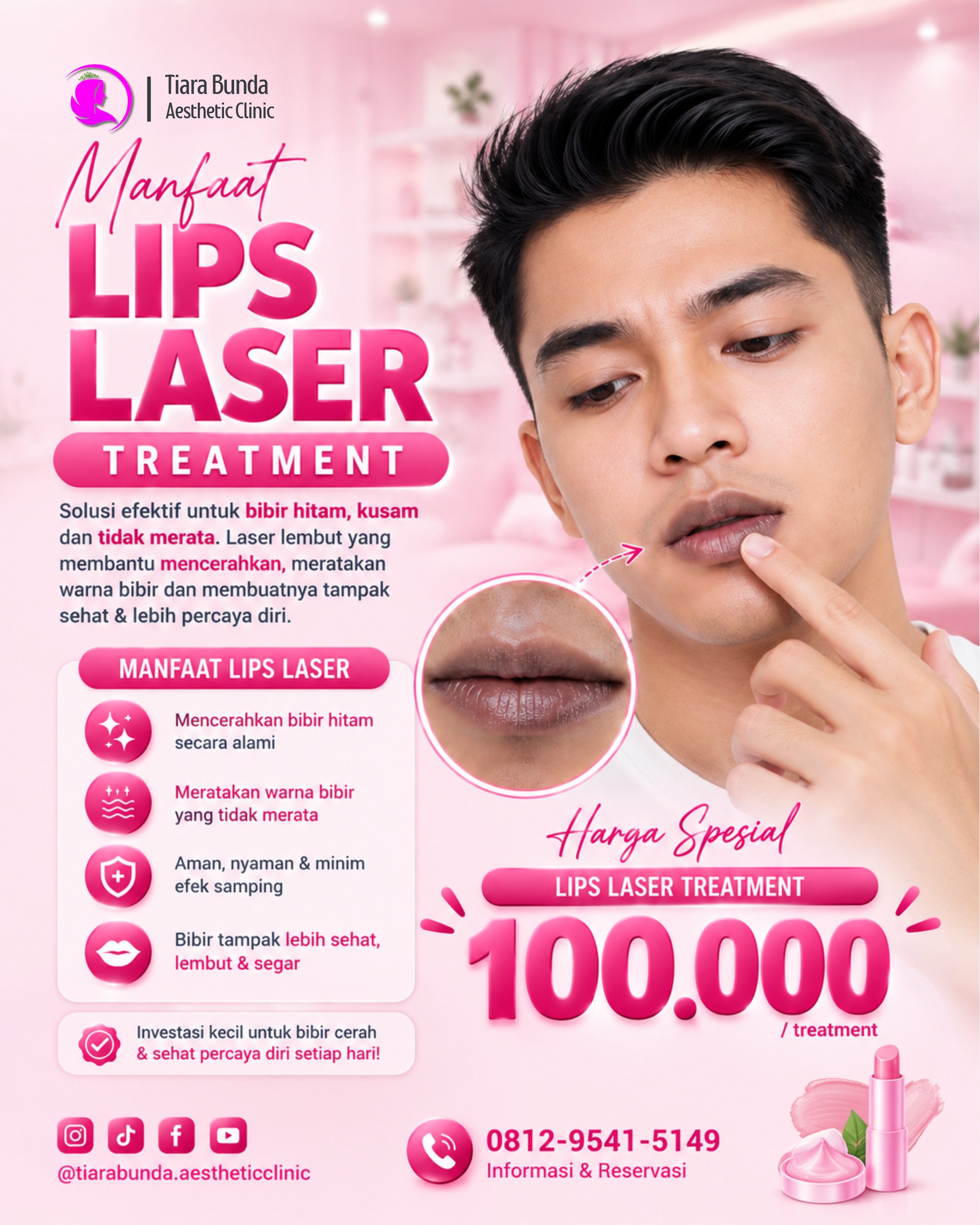 Laser Bibir  Hitam Treatment Bekasi